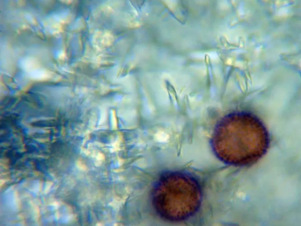 Microscopía de Mucilago crustacea - 10 - Capilicio con esporas